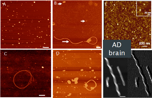 multiple images showing human tau aggregates in adult fly brain