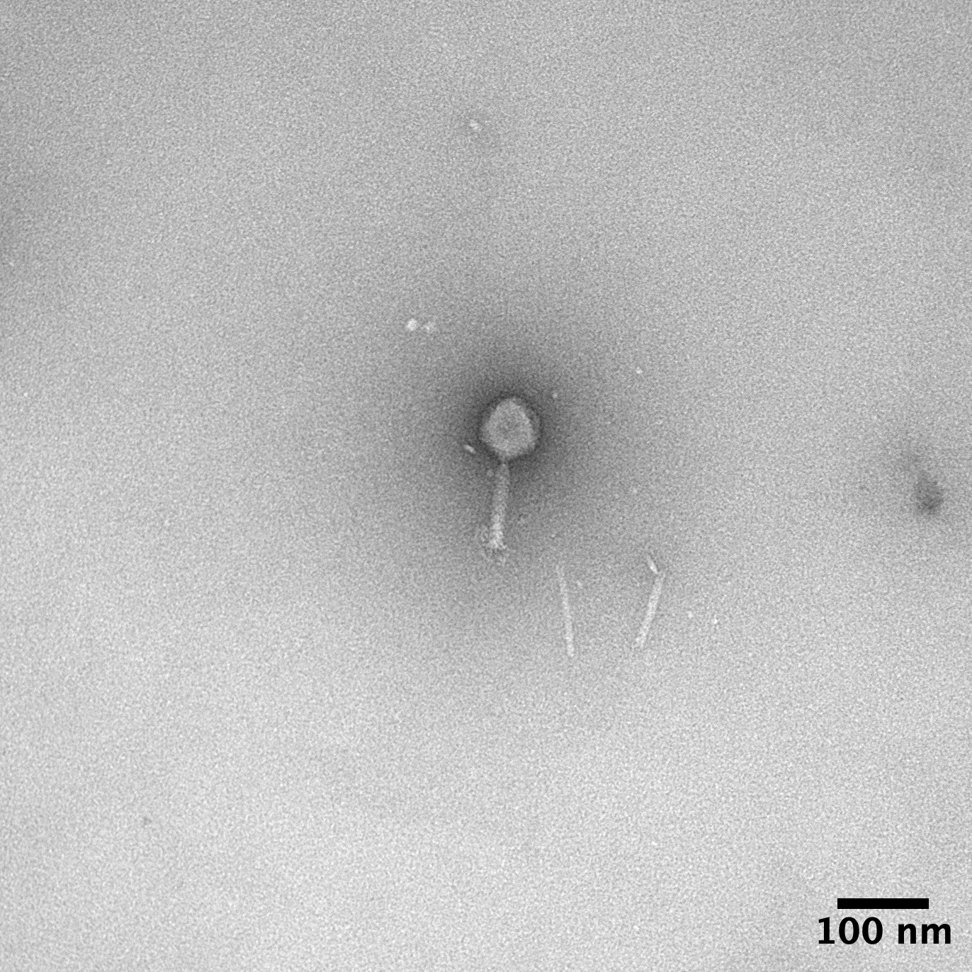 This image is a transmission electron microscope image of the phage RothD